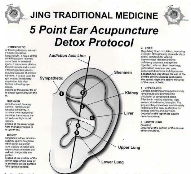 ear-points-jing-traditional.jpeg